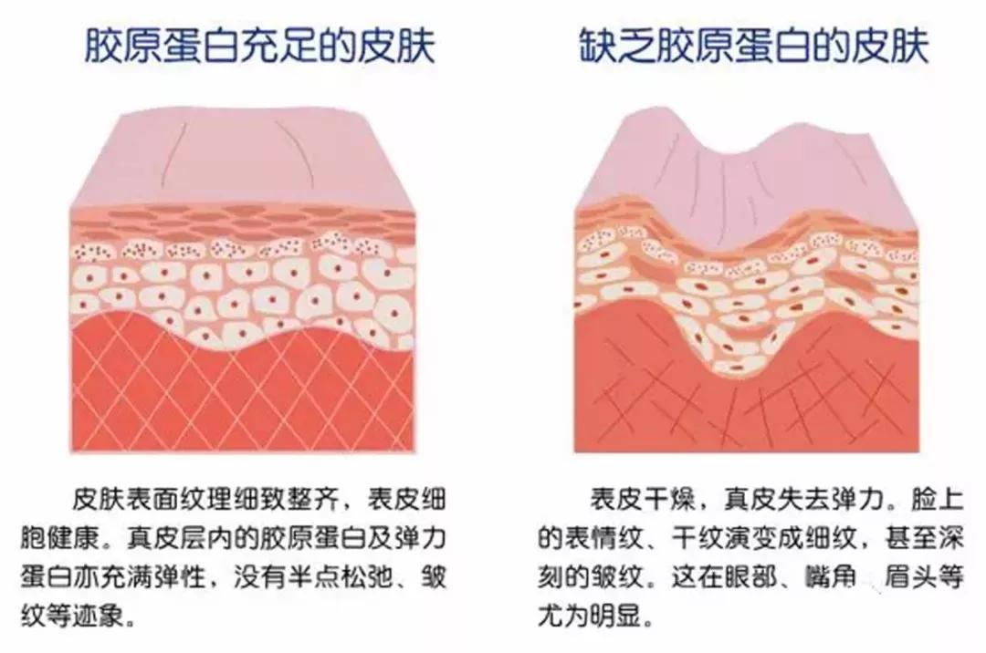 戴項鏈會長頸紋？真相遠遠不是你想的這樣！