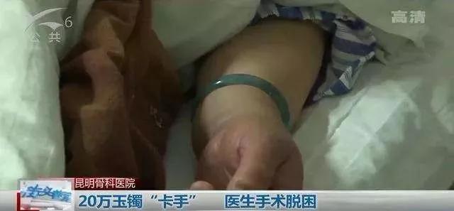 手鐲取不下來可以敲碎嗎？這些首飾不卡手，手鐲取不下來有妙招圖