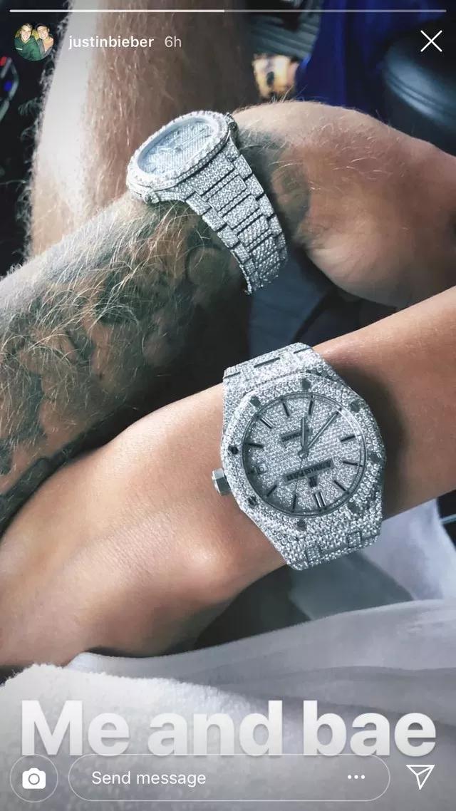 送老婆鴿子蛋鉆戒，連牙套都鑲鉆，比伯富到流油竟然只有26歲...