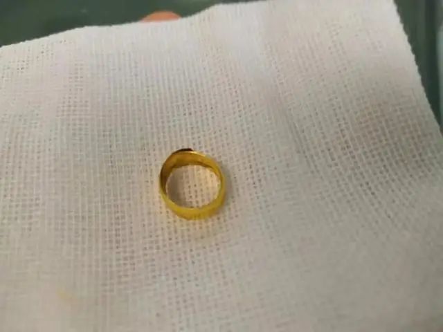 廣東寶寶滿月戴五個金戒指,之后發生的事太可怕
