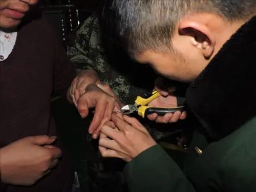 珍珠戒指竟是最危險的首飾?又有人為它破財傷身,差點手都“廢”了…