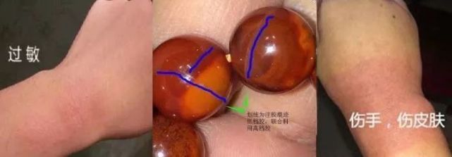 琥珀｜這5種珠寶個個有毒、害人不淺！你可能還在戴它.....