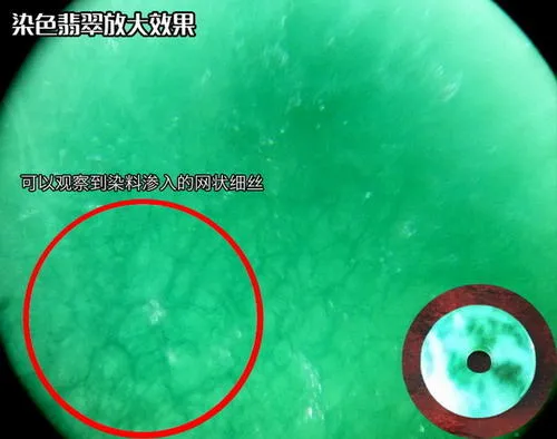 婆婆給兒媳的百萬級“傳家寶”玉鐲,竟會導致不孕不育?